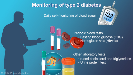 Diagnosis of Type 2 Diabetes - Slide Show - 16